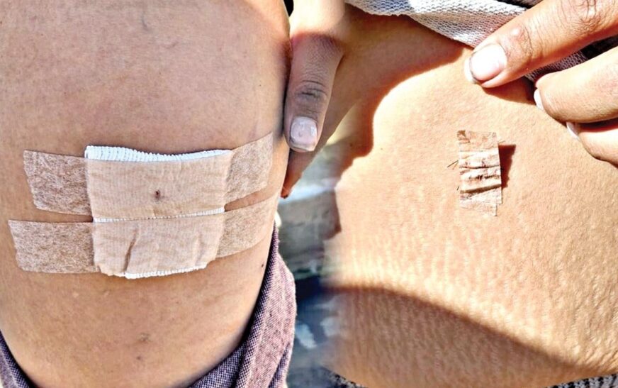 Cochabamba: Pareja apuñala a mujer en tentativa de feminicidio; detenido