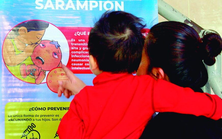 Alerta sanitaria por sarampión: 20 casos y foco en Santa Cruz