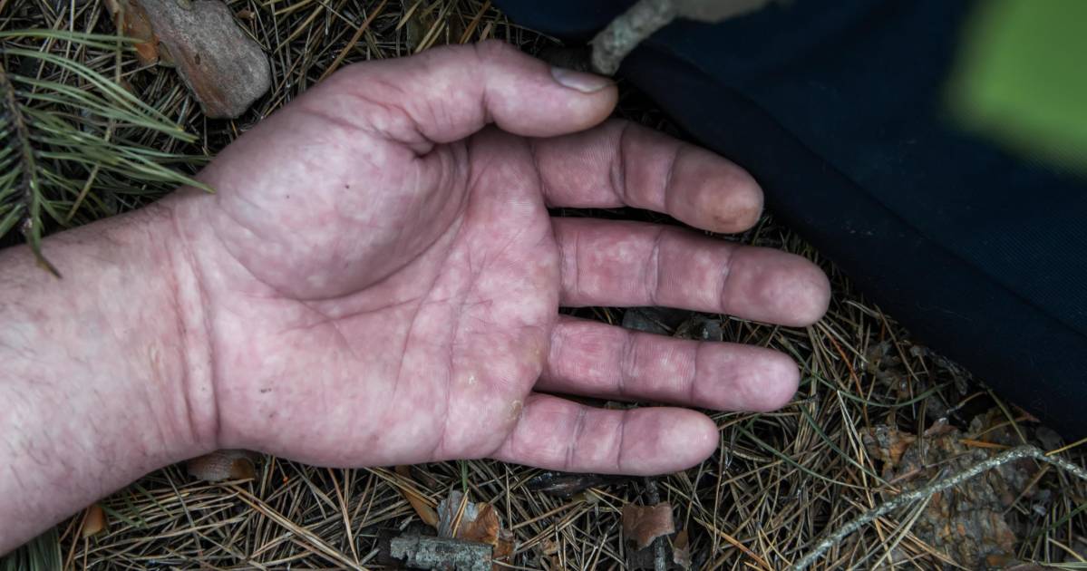 Policía de Cochabamba confirma muerte de hombre sorprendido robando moto